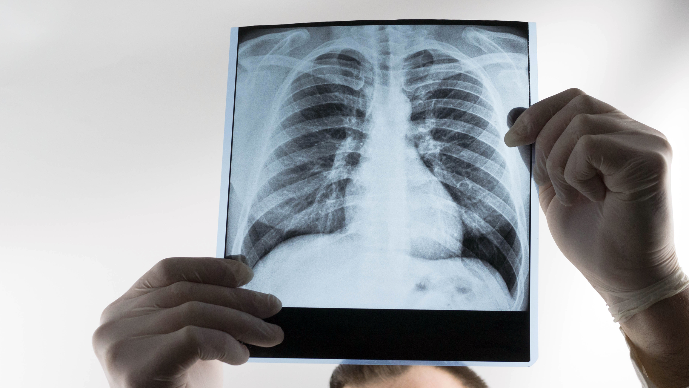 X-ray of human lungs being examined by a doctor